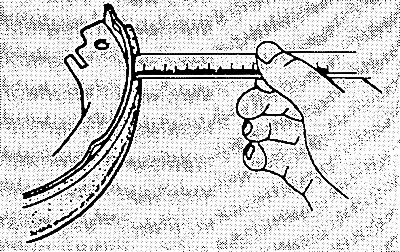 В сомнительных случаях снять тормозной барабан и измерить толщину накладки (рабочего слоя). Граница…